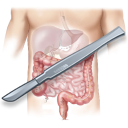 Chirurgie Viscérale